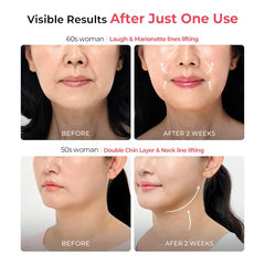 Aalok Ultra Olla face-lift morning routine closeup illustrating quick 10-minute sessions.