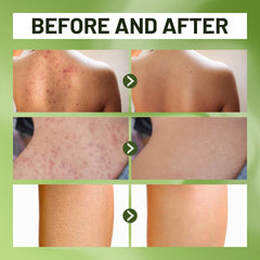 ABERA wild bitter melon extract closeup highlighting botanical cleansing