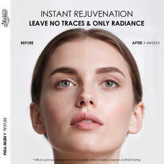 ACENICE TXA+Niacinamide 15% Glow Serum application on face demonstrating quick absorption