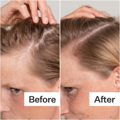 ACT+ ACRE peppermint cooling-effect close-up signals soothing scalp comfort.