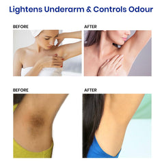 Actitud Underarm Roll On Serum brightening before-after transformation visualization.