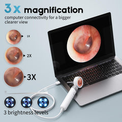 Aertnelz Otoscope magnification helps precise 3x zoom checks