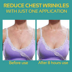 AGOPLEE Chest Wrinkle Pads on skin demonstrating gentle overnight treatment