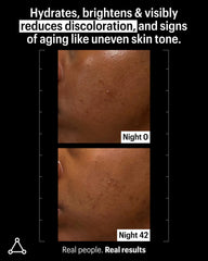 Allies of Skin salicylic acid closeup supports clear pores and refined texture.