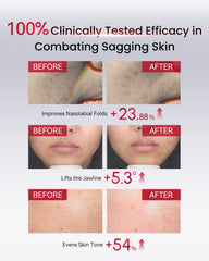AMIRO microcurrent device paired with PDRN serum enables at-home treatment.