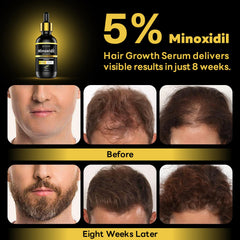 Andelusita biotin scalp nutrients image emphasizes nourishing ingredients for follicles.