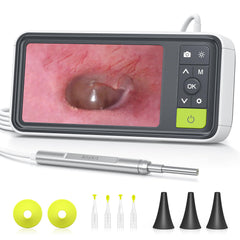 Anykit Digital Otoscope shows a clear live ear view on the 4.5-inch screen for easy inspection.