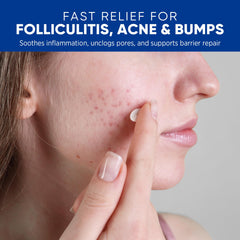 AOSORW Folliculitis Cream facial care for gentle daily use