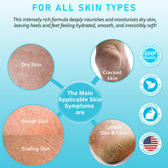 Aphesia Urea 40% cream label close-up highlights a clean, paraben-free formula.
