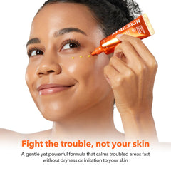 APRILSKIN Carrotene IPMP clearing solution applied to acne-prone skin.