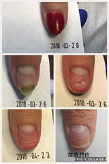 ARKADA Natura Resort Amazon TC16 in-skin application demonstrates quick absorption.