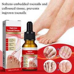 AUJ ingrown toenail drops application brush enables precise use.