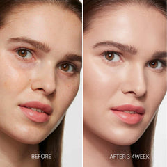 Aurivoy dark spot remover hand application illustrates fast-absorbing formula for daytime use.
