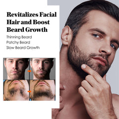 AVITAPURE minoxidil beard growth oil packaging close-up highlighting nourishing formula