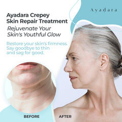 AYADARA Crepey Skin Repair Cream close-up reveals nourishing honey and shea for skin nourishment.