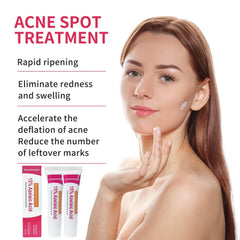 Azelaic Acid Acne Cream texture close-up highlights micro-encapsulation for sensitive skin