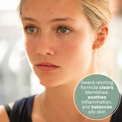 Balance Me Congested Skin Serum dropper closeup highlights precise application for blemish-prone areas.