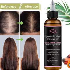 BALPPRD Lifewitqueenp herbal blend of 14 botanicals for balanced scalp.