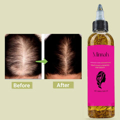 BALPPRD Minnah Batana Oil dropper demonstrates easy scalp application.