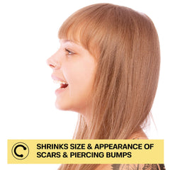 BASE LABORATORIES keloid bump removal drops close-up showing natural formula.