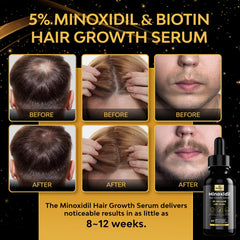 Beaueli minoxidil foam-dispense-action close-up shows easy, mess-free application.