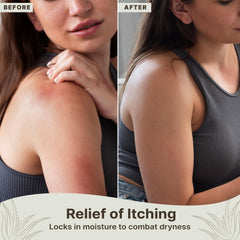 Beauty by Earth Aloe Vera Gel sunburn-after-sun demonstrates cooling comfort.