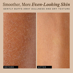 Beauty by Earth cellulite-massage brush helps improve skin texture and tone