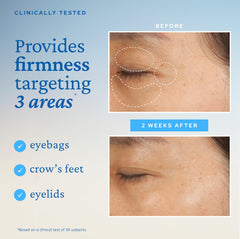 belif Peptide Eye Bomb ceramide and squalane support moisture barrier for lasting hydration.