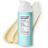 BellamiLuxx cystic acne bottle close-up showing targeted treatment for redness and pimples.