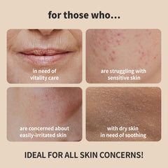 BENTON Snail Mucin Toner essence application demonstrates hydration for soft, resilient skin