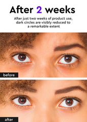 BE+WANTS under eye cream packaging highlights vegan collagen and calendula retinol.