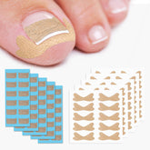 BEZOX ingrown toenail patches pack open for easy, on-the-go relief