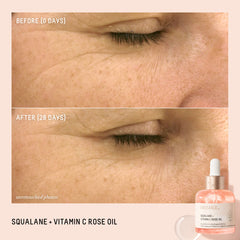 BIOSSANCE dropper delivers vitamin C rose for radiant glow.