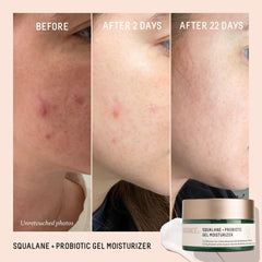Close-up of encapsulated probiotics technology in Biossance moisturizer highlights potent active delivery.