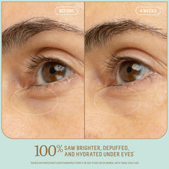 Biossance eye serum brightening dark circles around the under-eye