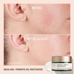 Biossance bisabolol chamomile extract close-up highlights gentle redness relief.