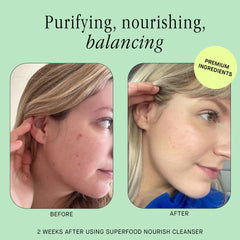 Brandefy Superfood Face Wash foaming lather, gentle enough for sensitive skin in daily routines.
