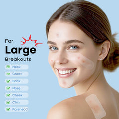 Breiboz pimple patches on forehead during application for discreet acne care