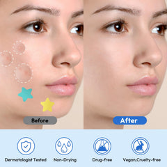Breiboz individually packaged pimple patches for on-the-go protection and freshness