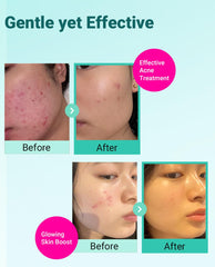 BRING GREEN Zinc Teca Serum close-up shows lightweight blemish targeted formula
