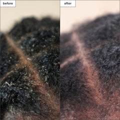 Binchotan charcoal close-up detoxifies impurities.