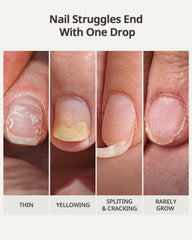 BTArtboxNails Naillush nails before and after repair comparison