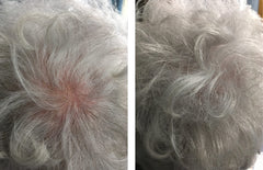Caboki bald-spot concealment blends seamlessly with existing hair.
