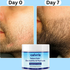 Calvris Scalp Comfort Balm texture closeup highlights lightweight, non-greasy feel.