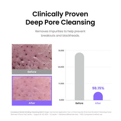 Caraseoul non-comedogenic vegan formula cleanses without clogging pores.