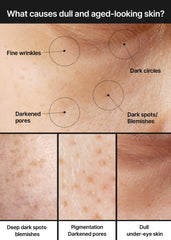 Celimax Niacinamide 5% label highlights brightening support.