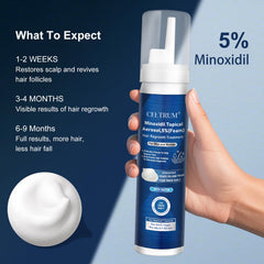 Celtrum Minoxidil Foam dispense close-up highlighting precise scalp application.