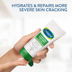 Cetaphil Cracked Skin Repair Balm on heel shows repair of rough, cracked skin.