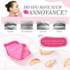Charm Kiss lip mask close-up on lips shows smooth, moisturized skin.
