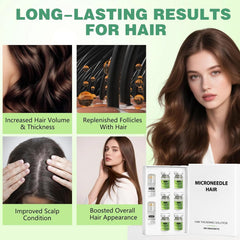 ChLNDalin Hair Regrowth System application scene ready-to-use daily routine